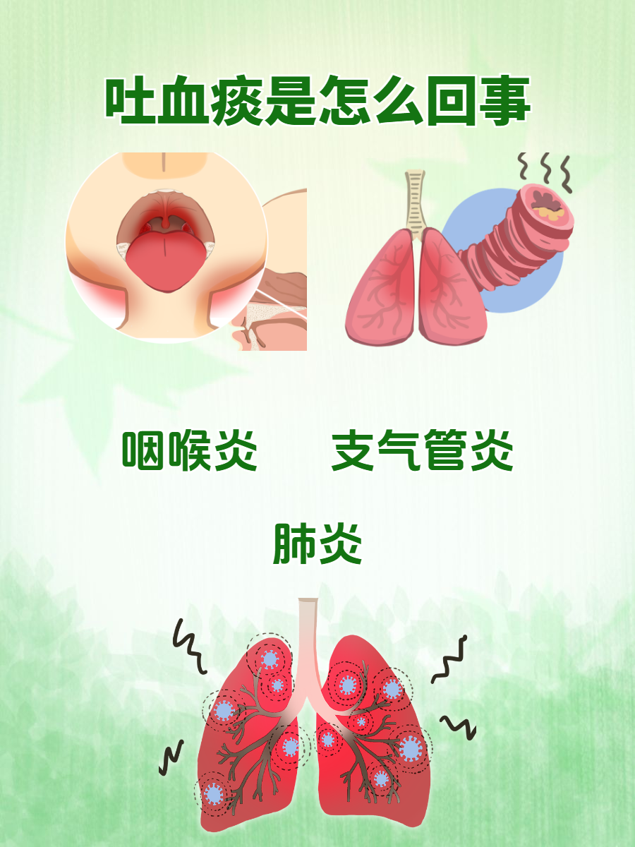 咳嗽时痰中带血能确定是肺癌吗
