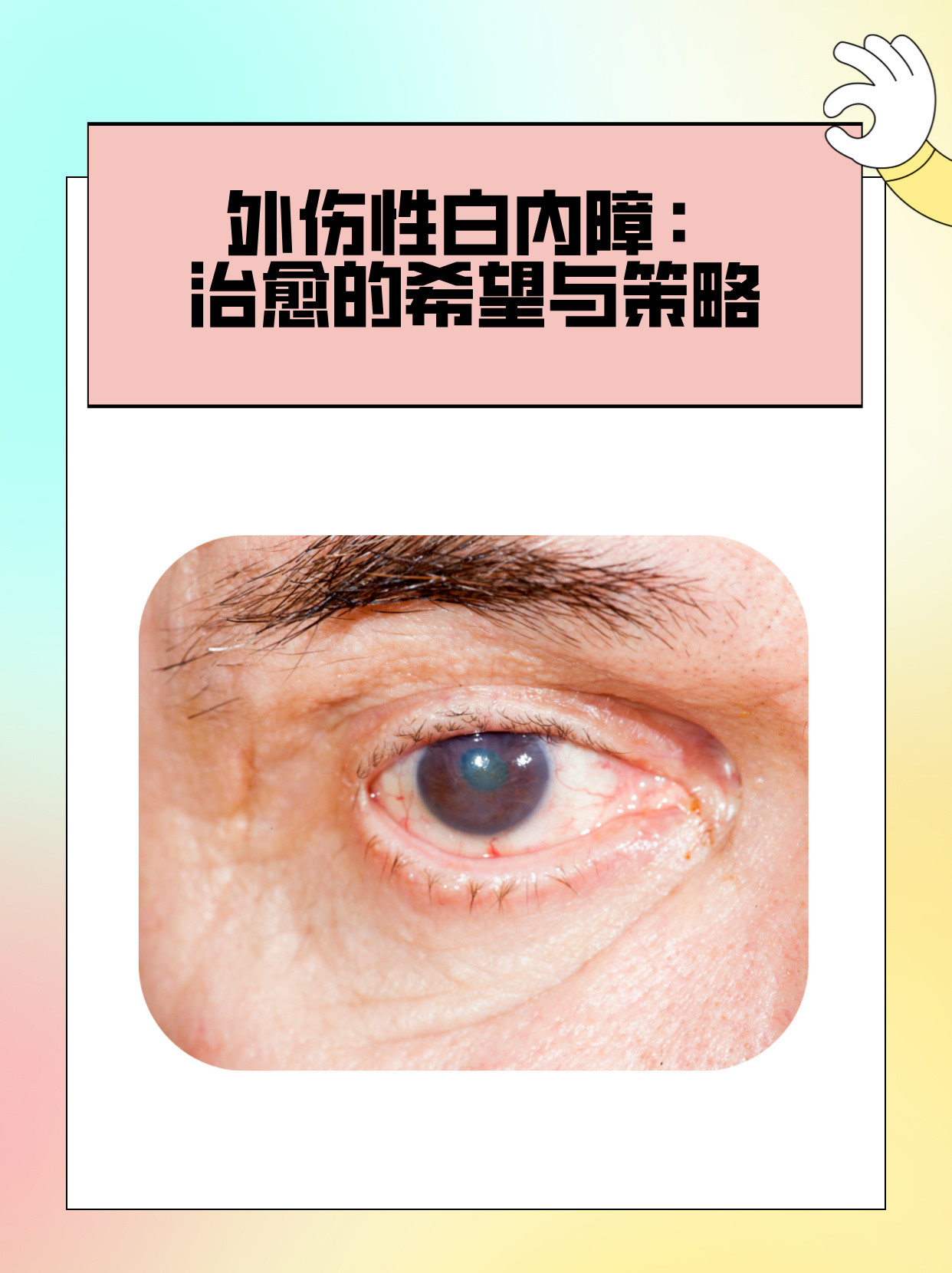 眼睛白内障的症状表现有哪些