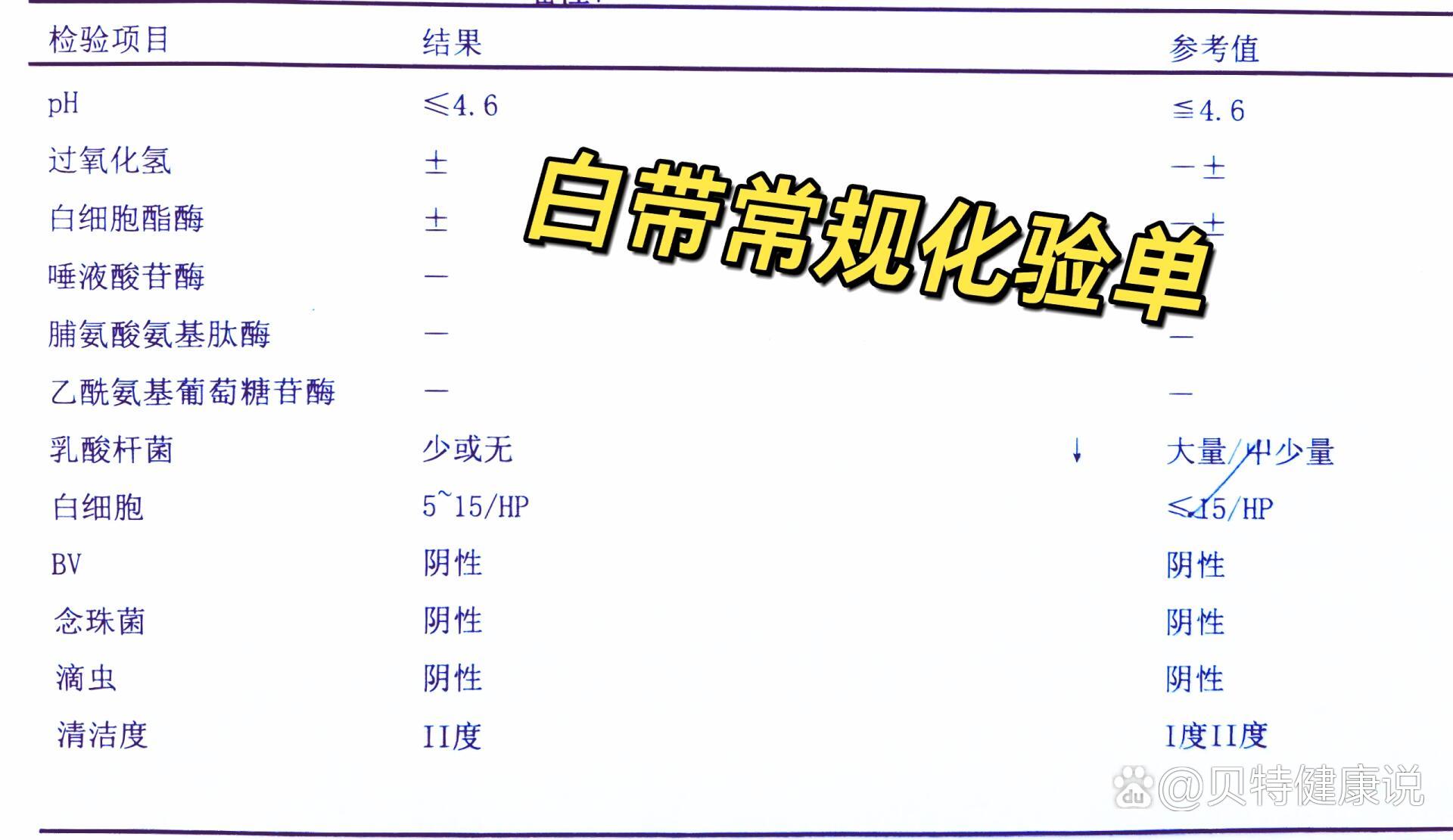 白带常规检查怎么做?