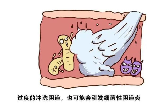 外阴阴道假丝酵母菌病怎么治