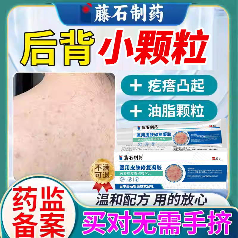 背后起痘痘如何清除
