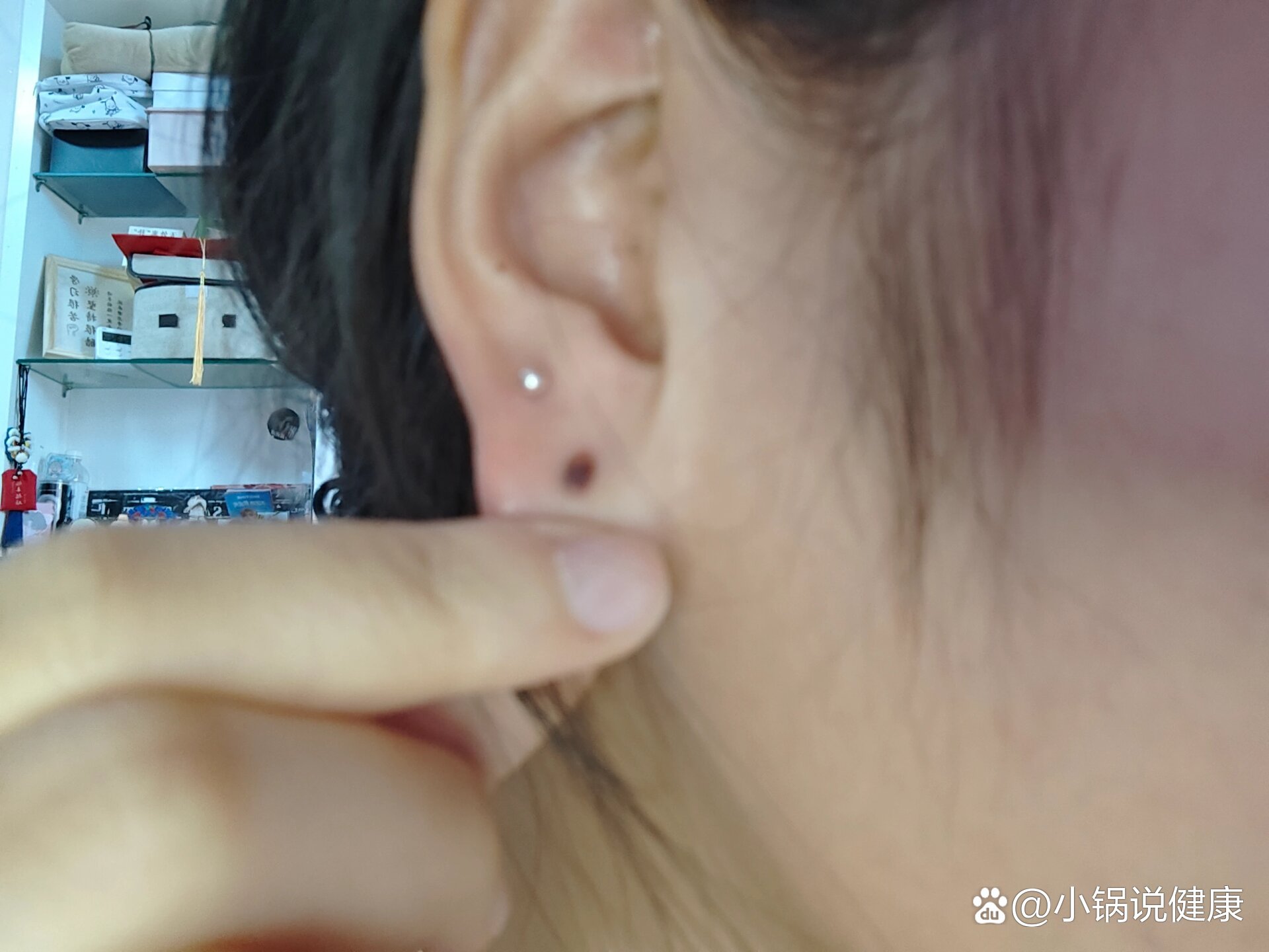 耳洞长死里面有硬块怎么办..