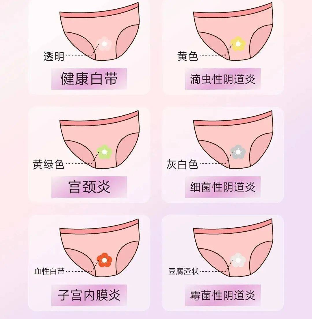 巢涵梅 第2页