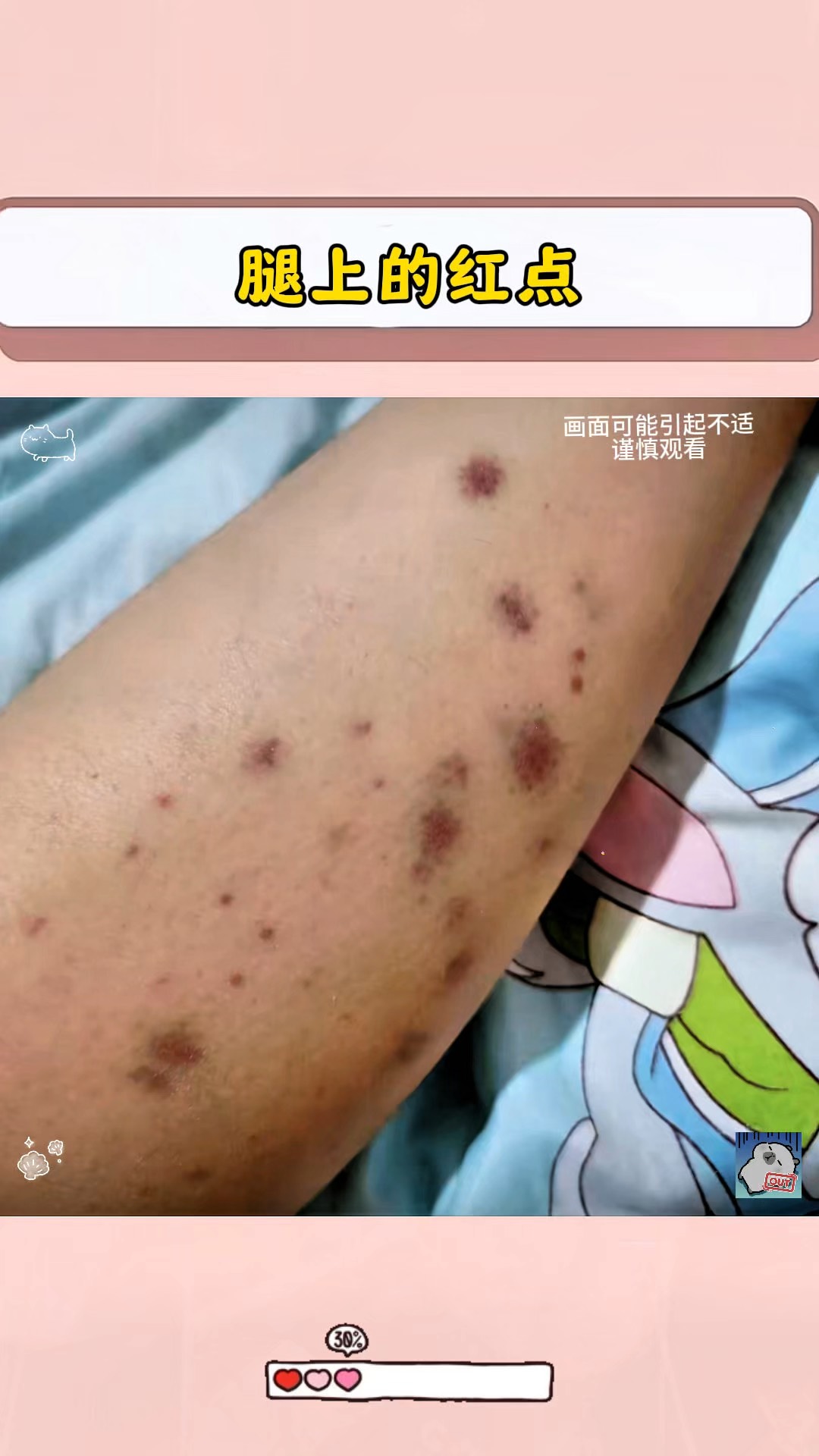 腿上有小红点怎么办