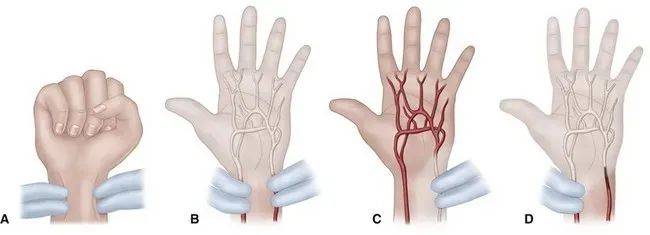 手腕动脉在哪(并不是想自杀