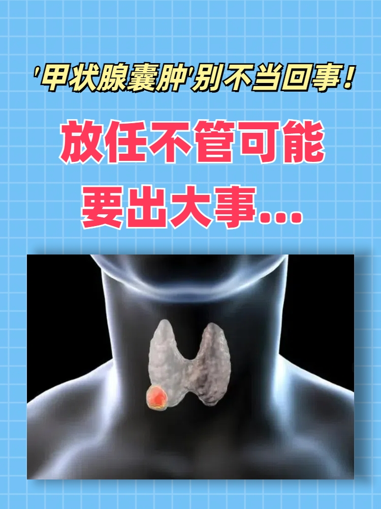 甲状腺疾病是什么病