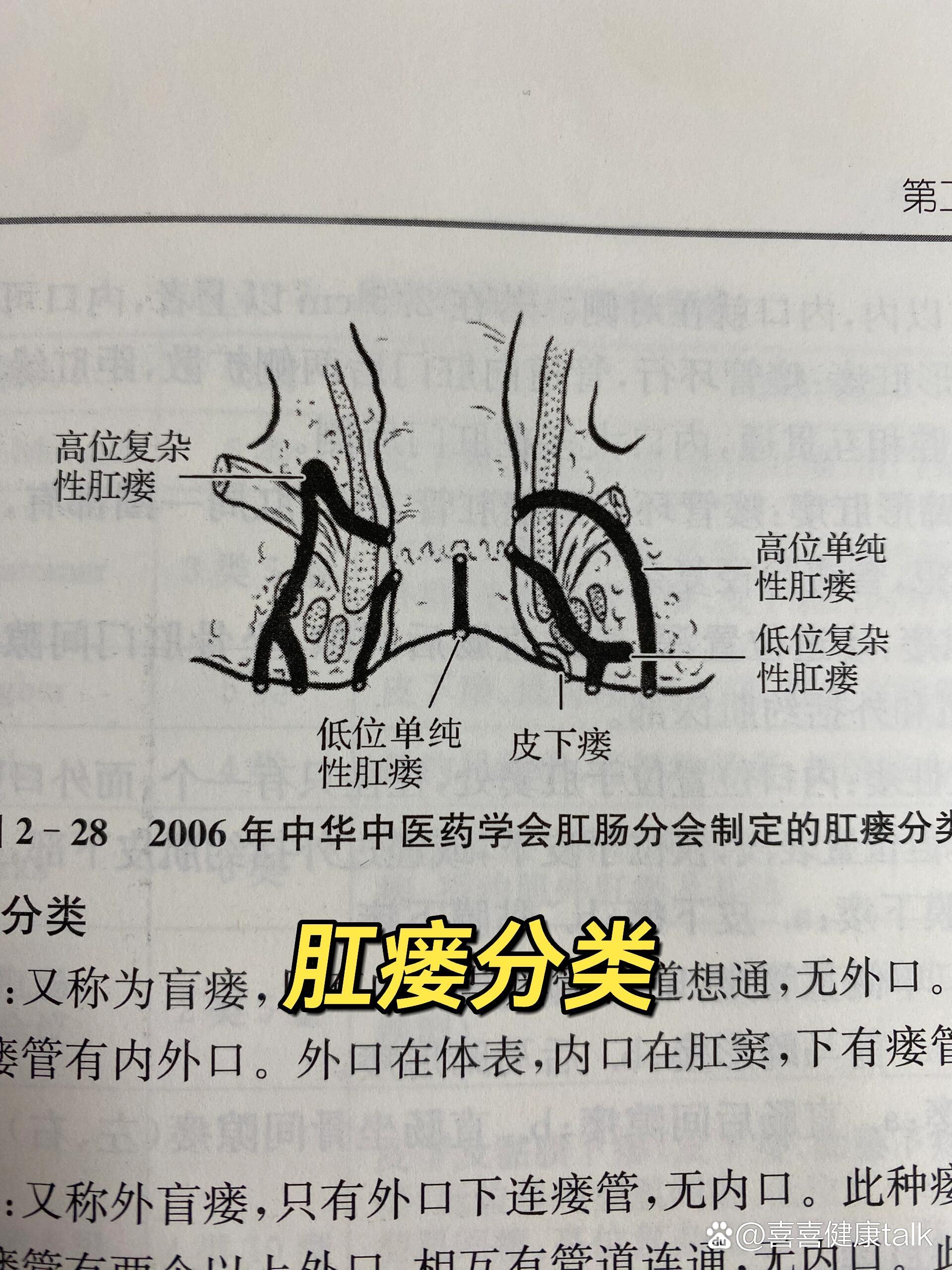 肛瘘会癌变吗