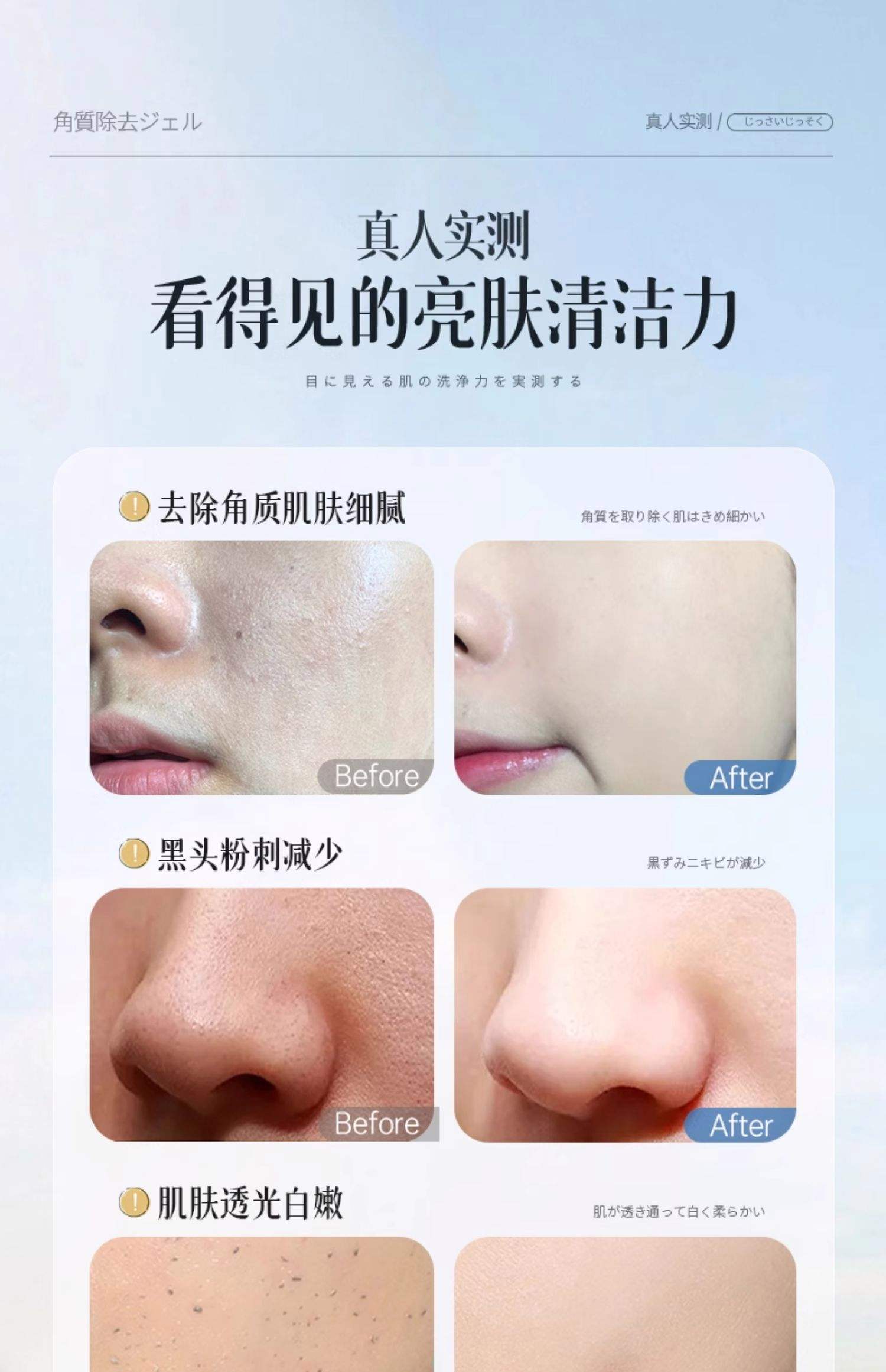 脸上有死皮怎么办