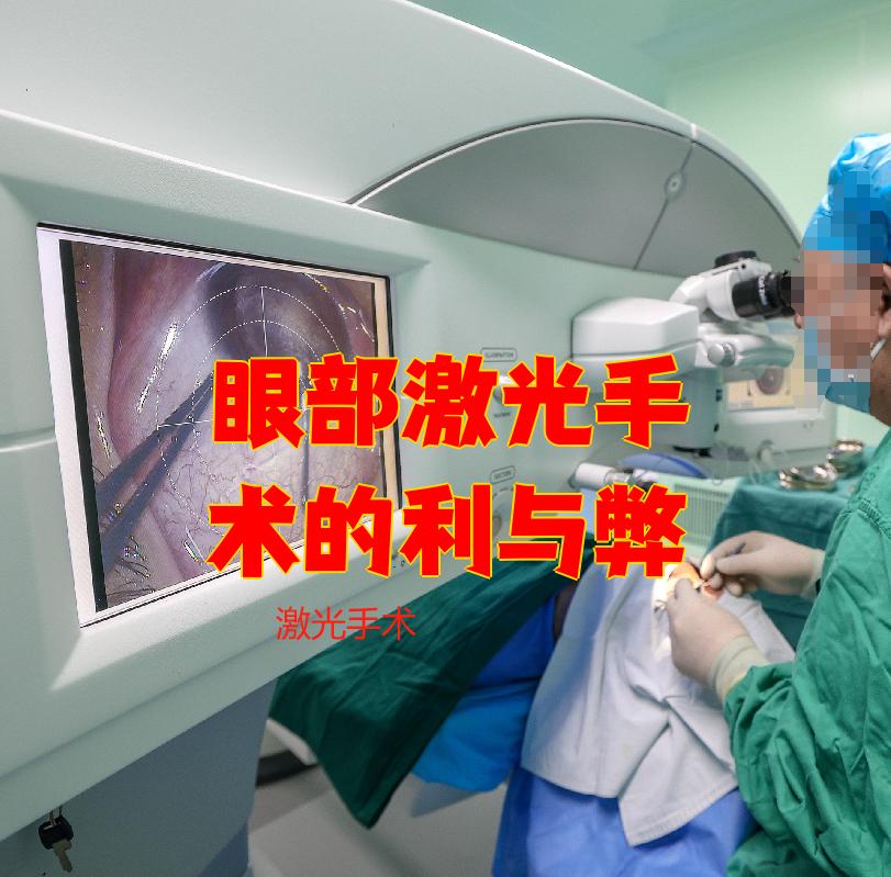 视力激光手术