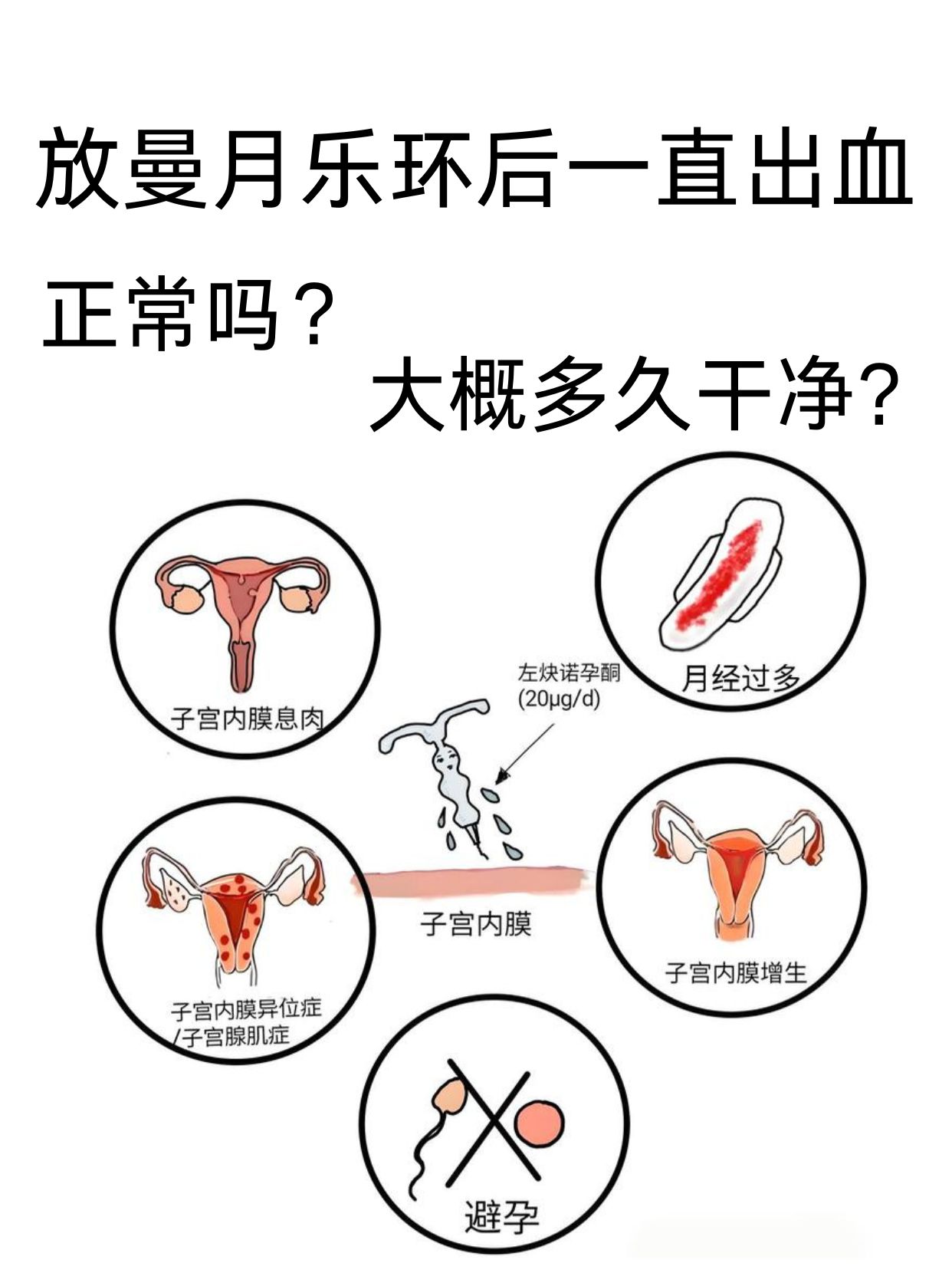 上曼月乐环的最佳时间是什么时候?