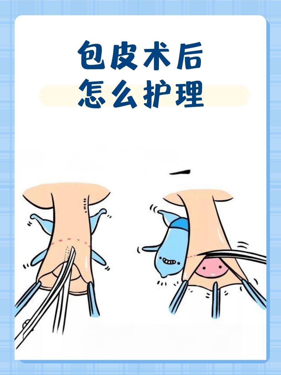 包皮手术后要休息多长时间