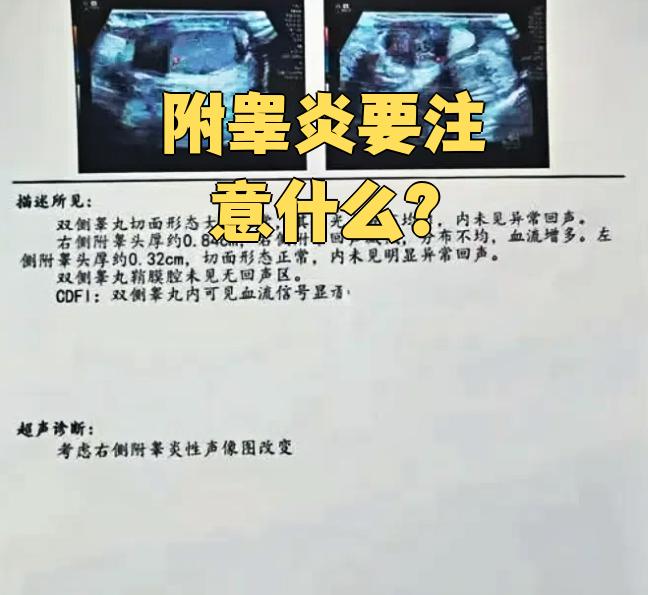 得了附睾炎严重吗?