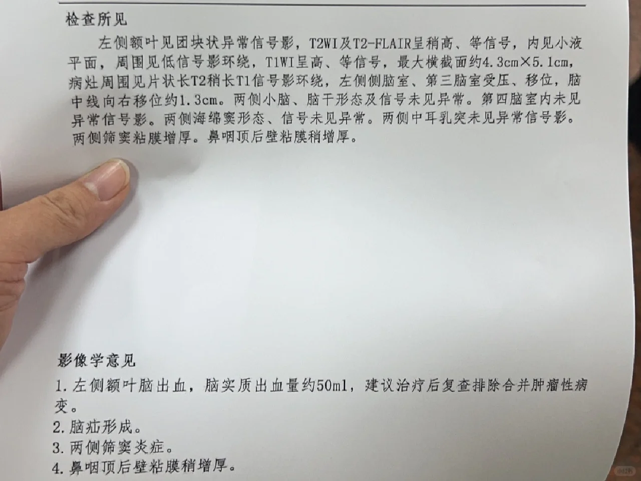 血压160mmHg严重吗