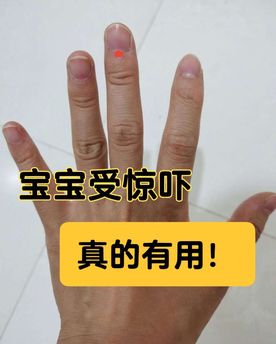 宝宝惊吓症状