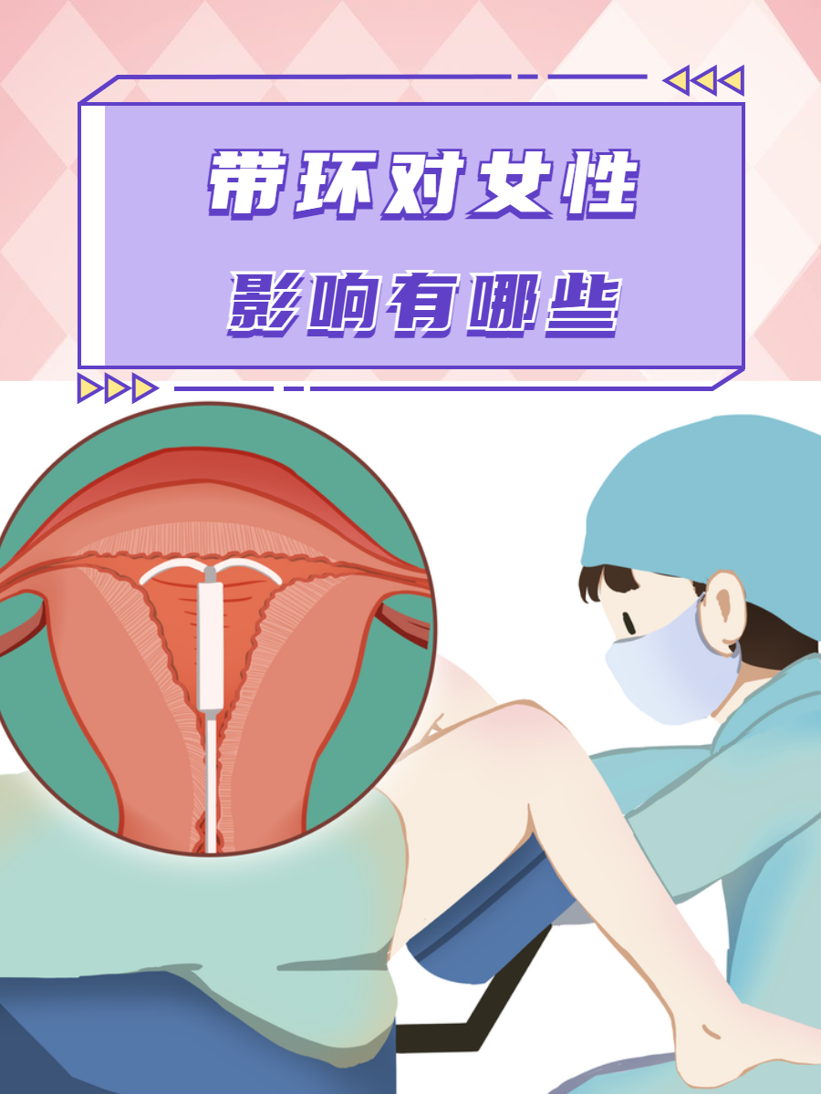 女性上环到底对身体好不好?