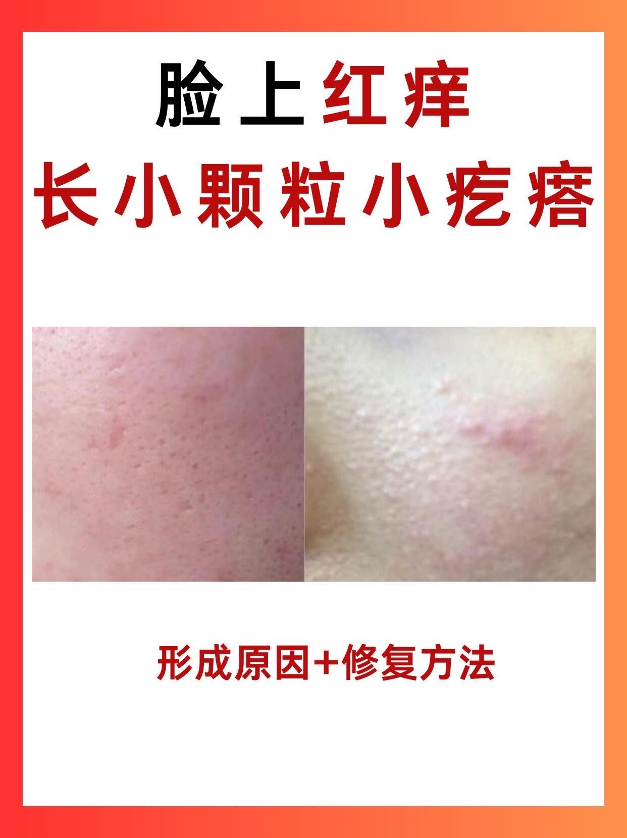 脸颊两边长小颗粒,该怎么处理