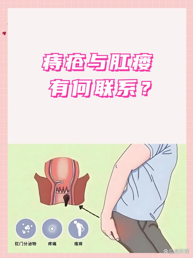 痔疮和肛瘘有什么区别
