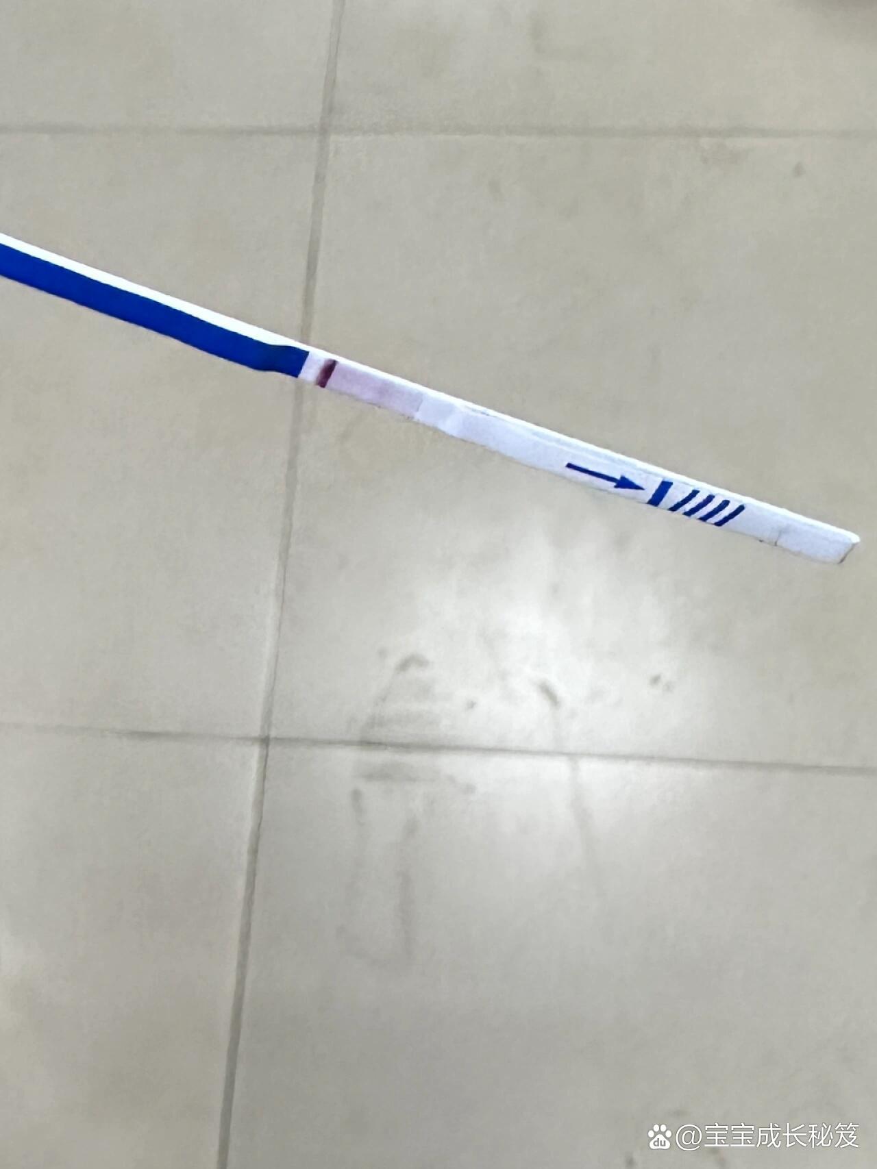 宫外孕试纸可以测出来吗