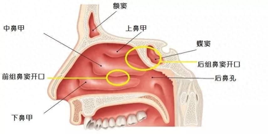 鼻窦癌早期的症状