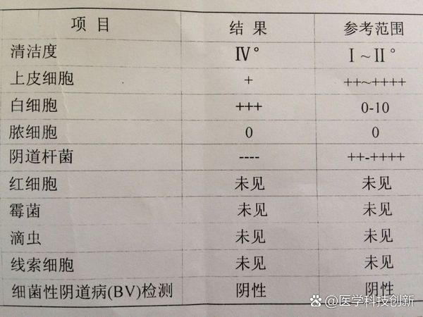 白带常规检查需要多久