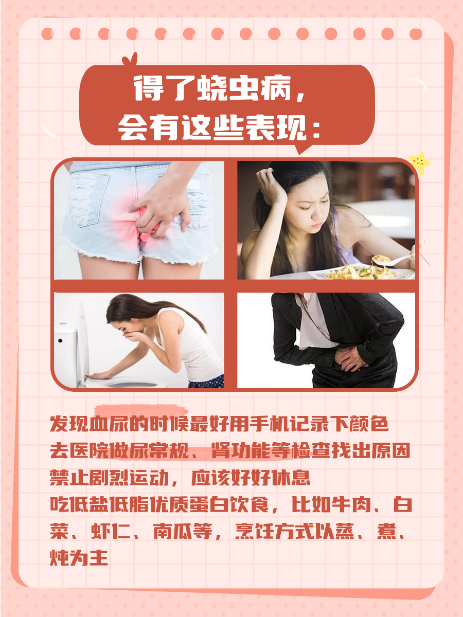 治疗蛲虫的最佳方法