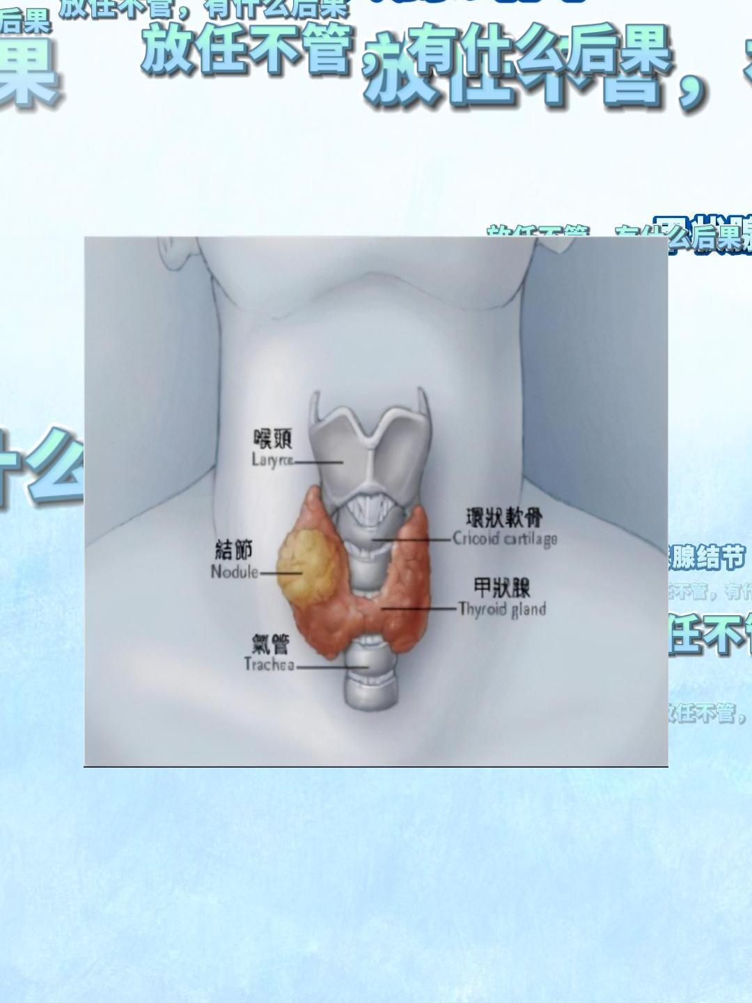 留暄莹 第2页