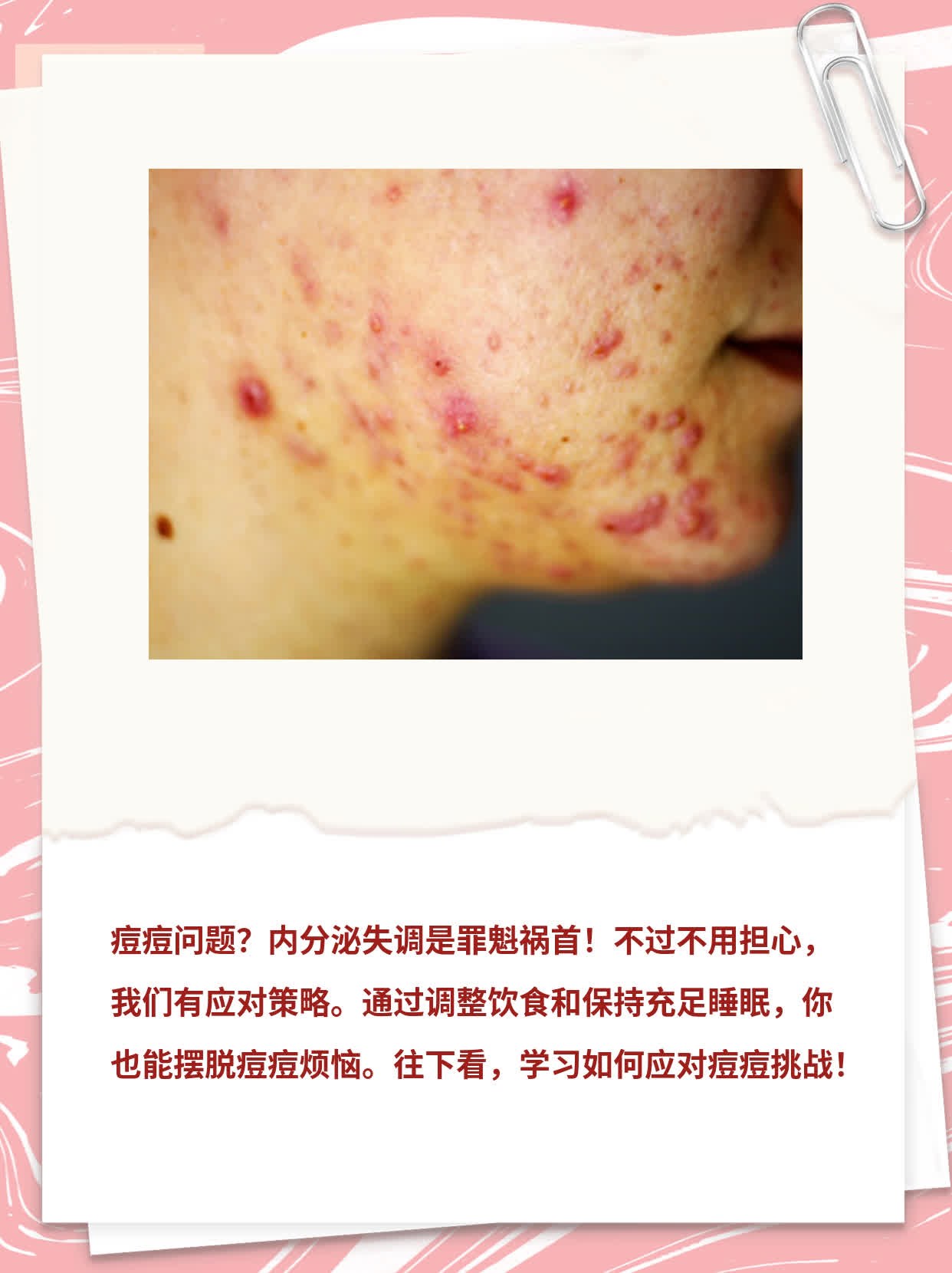 内分泌失调怎么样调理
