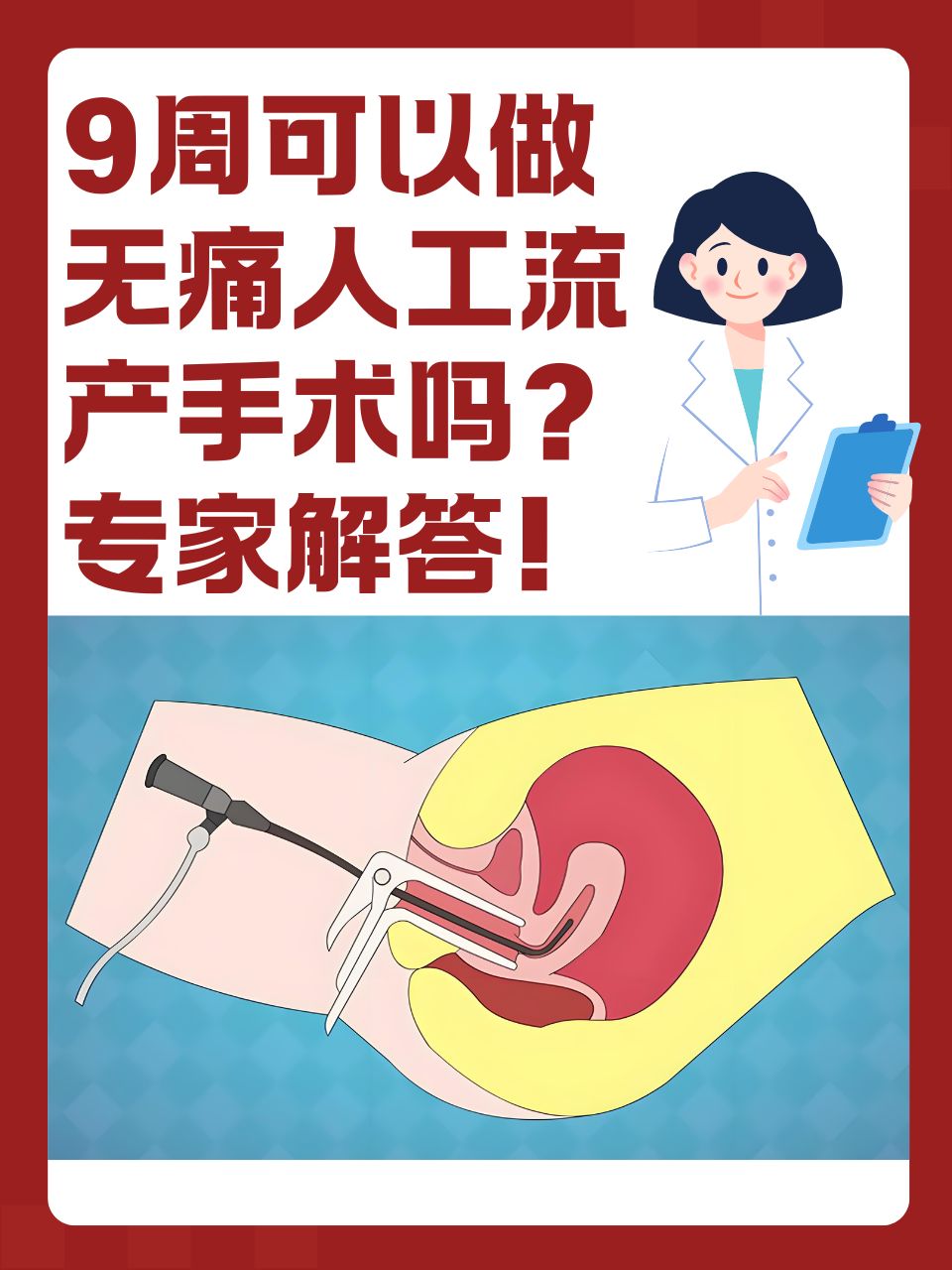 无痛人工流产手术