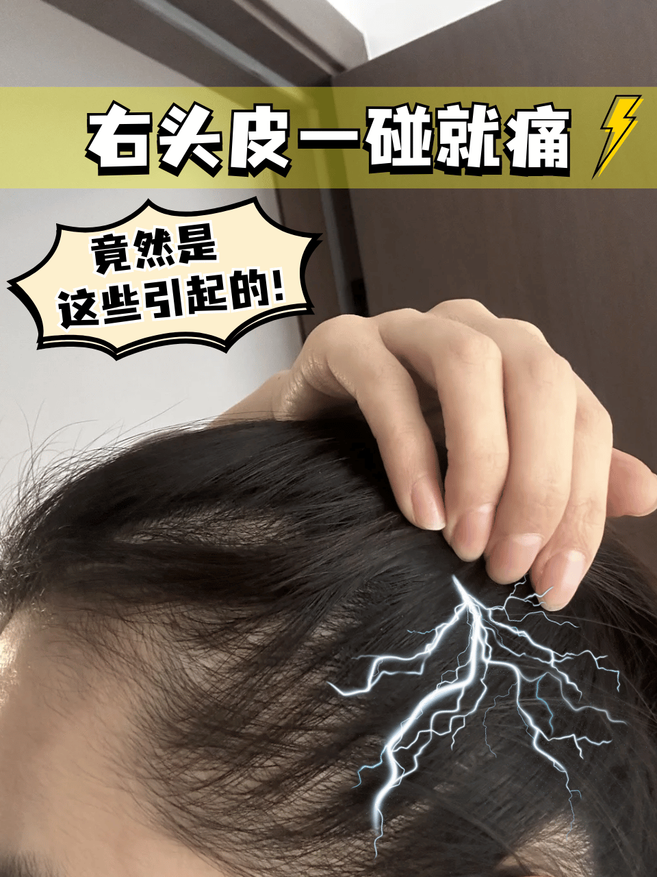 头皮发炎怎么治疗?