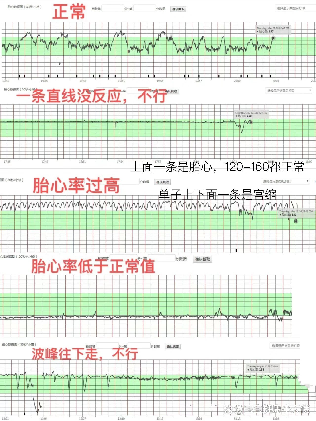 胎心率150正常吗