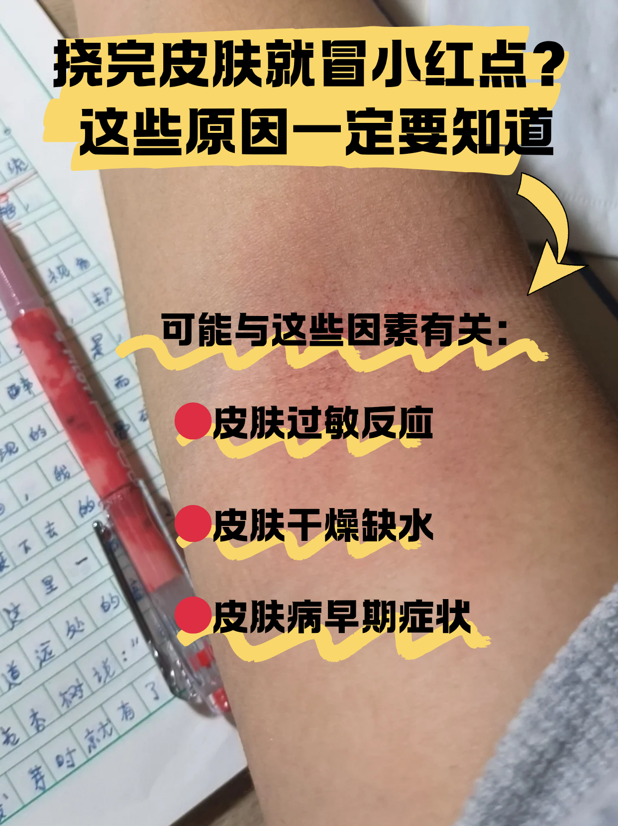 皮炎一般是由什么原因引起的