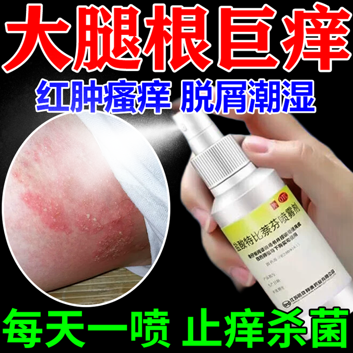 股癣如何用药?