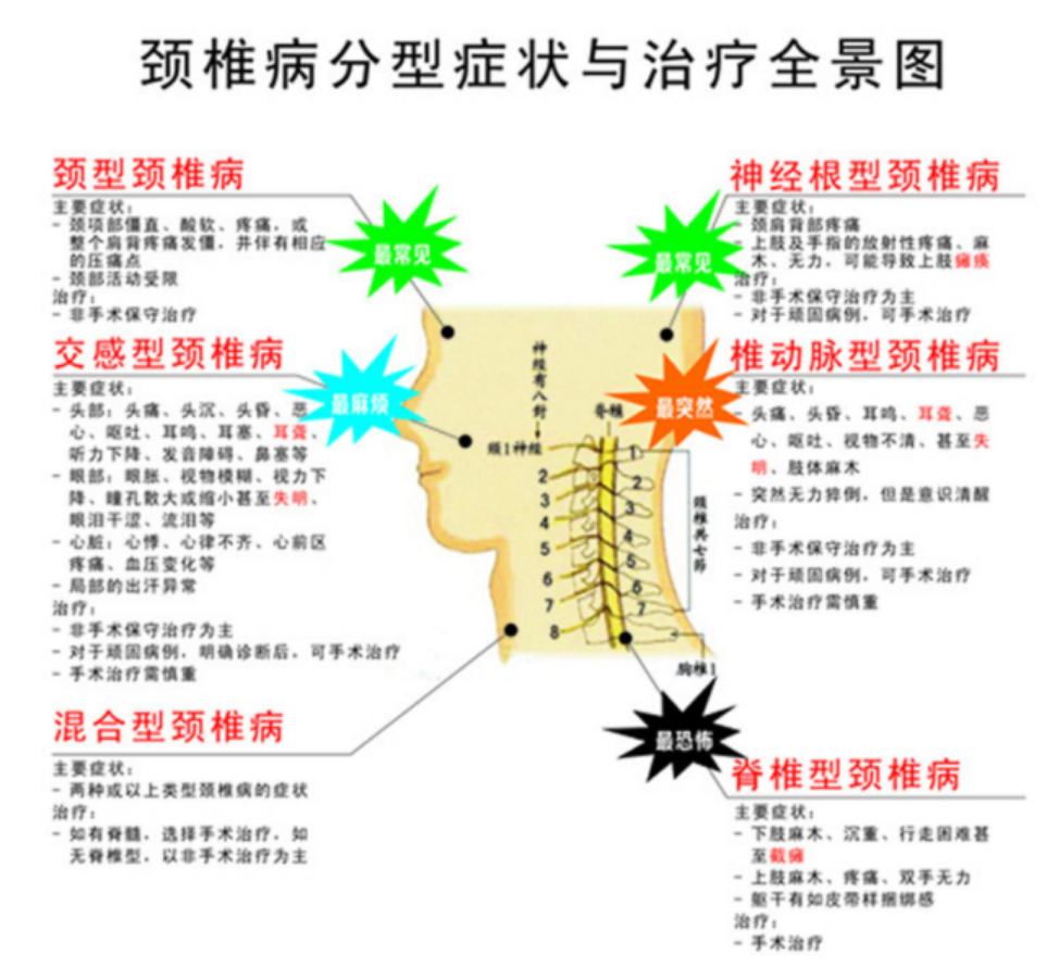 颈椎病压迫神经的症状有几种