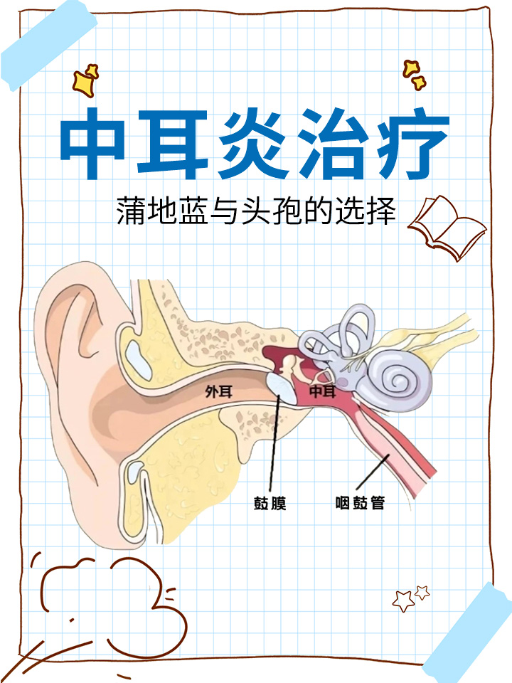 中耳炎流脓怎么办