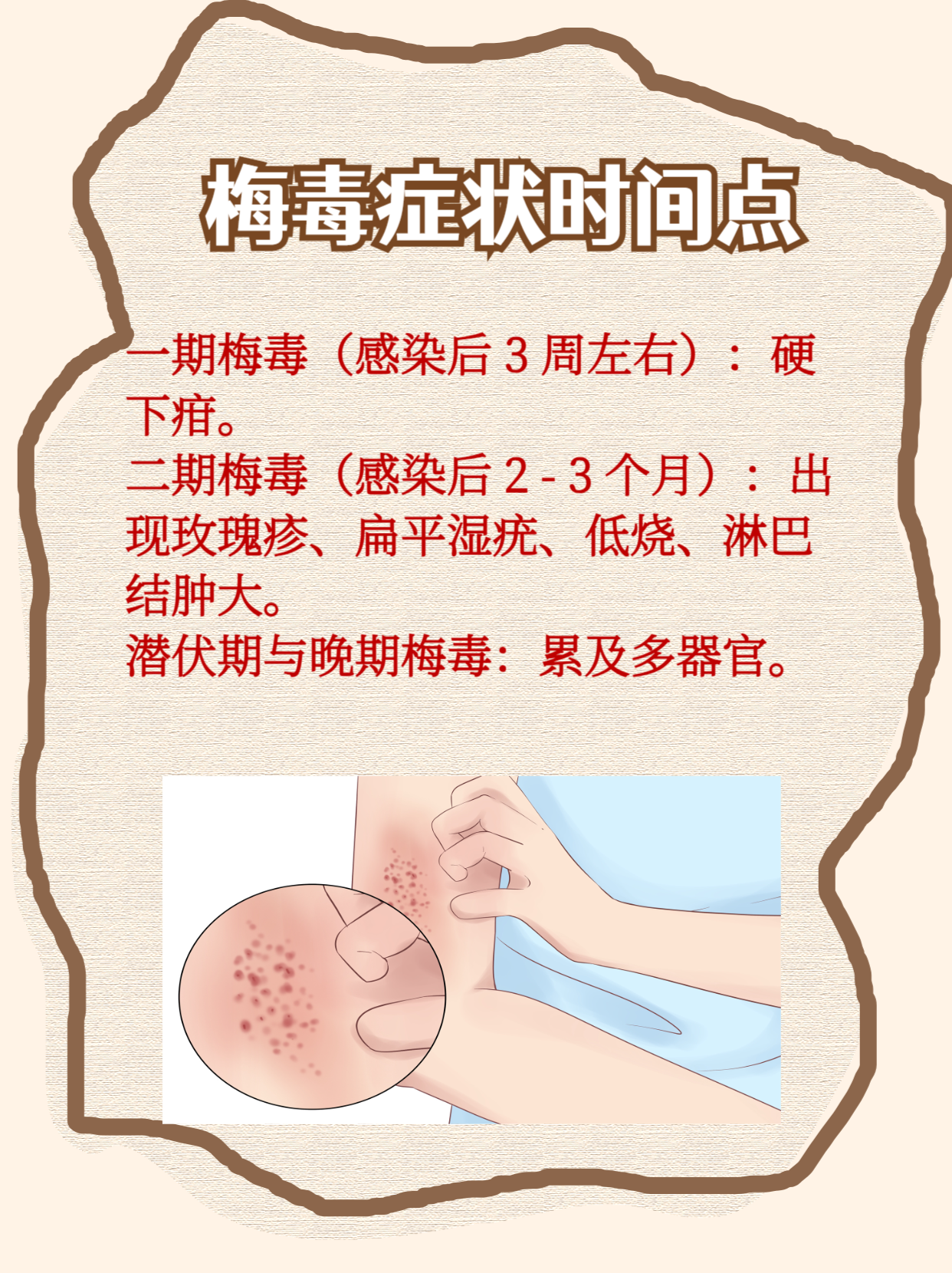 梅毒能治好吗?