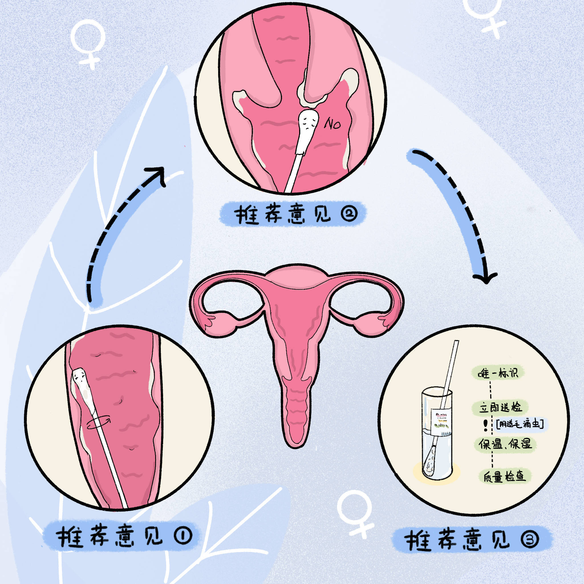 滴虫性阴道炎的白带是啥样的