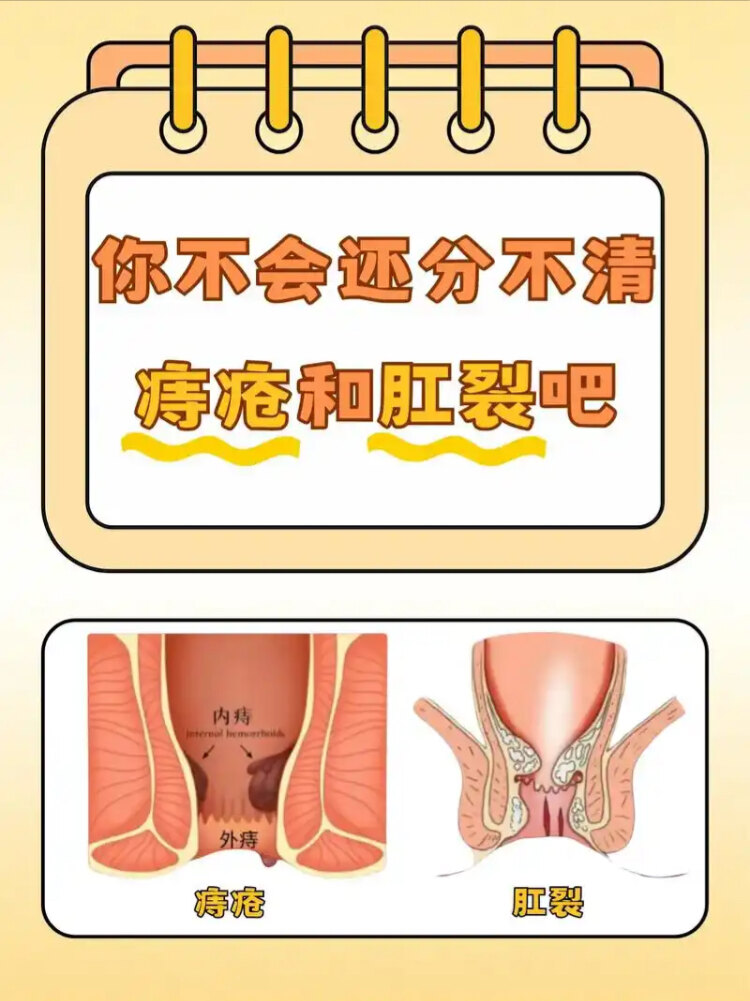 肛裂,可以自愈吗?