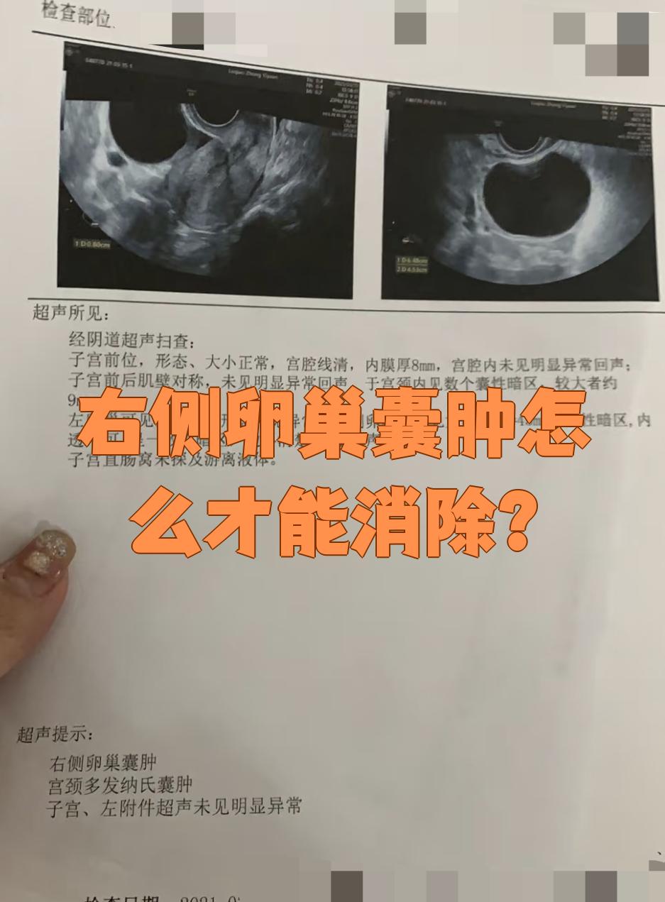 黄体囊肿会自己消失吗