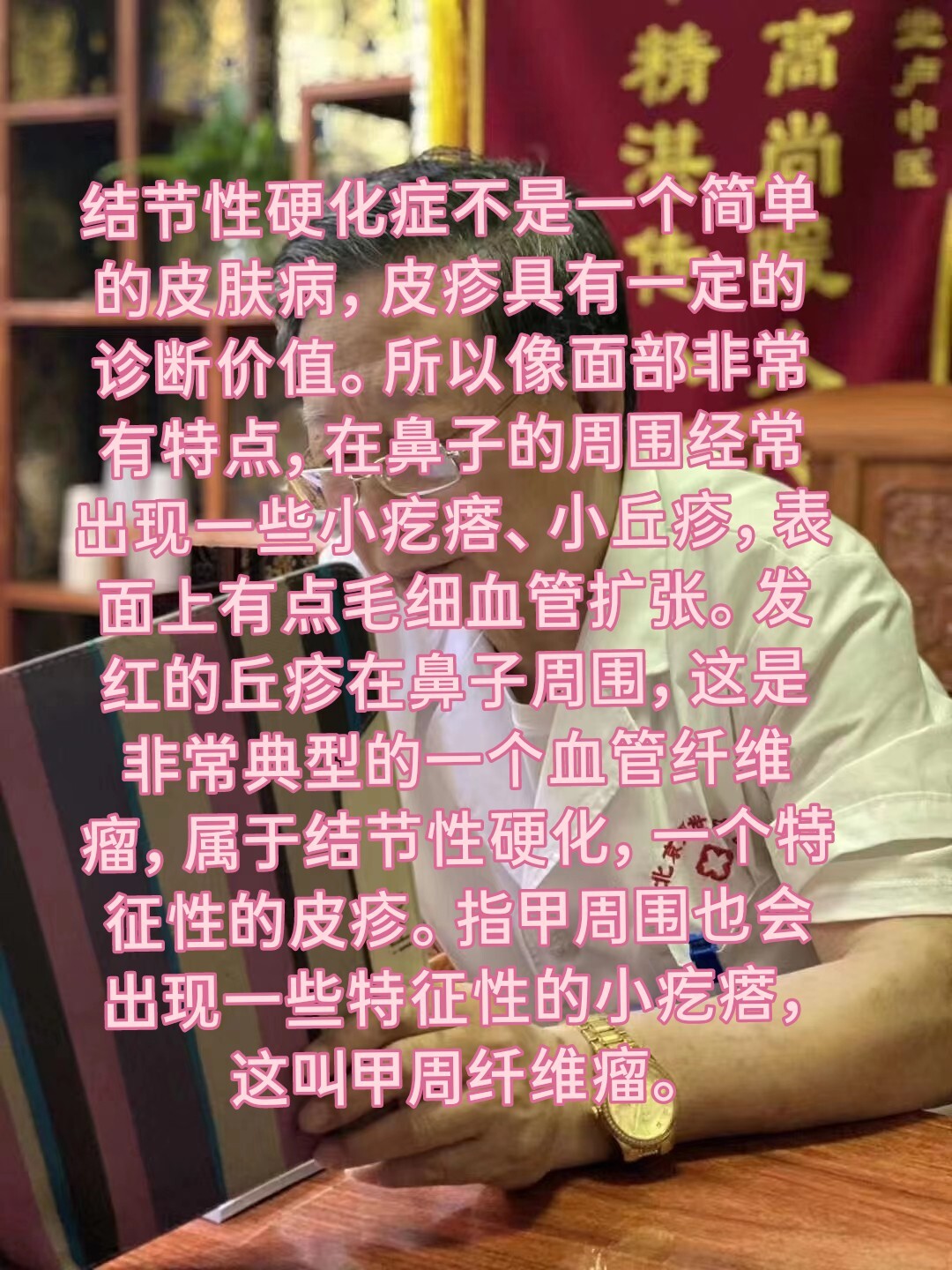 结节性硬化症的诊断及治疗