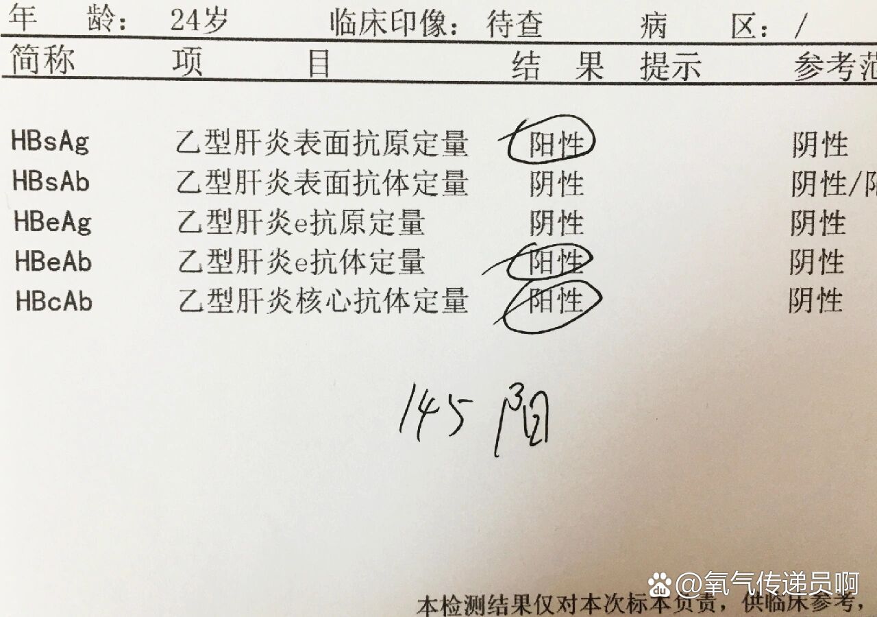 什么是乙肝阳性