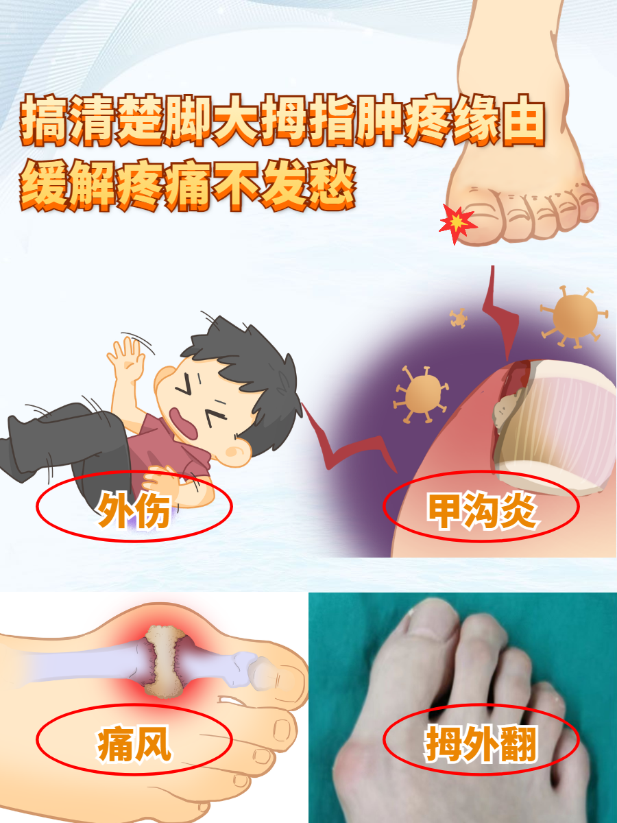 大脚趾疼痛是什么原因