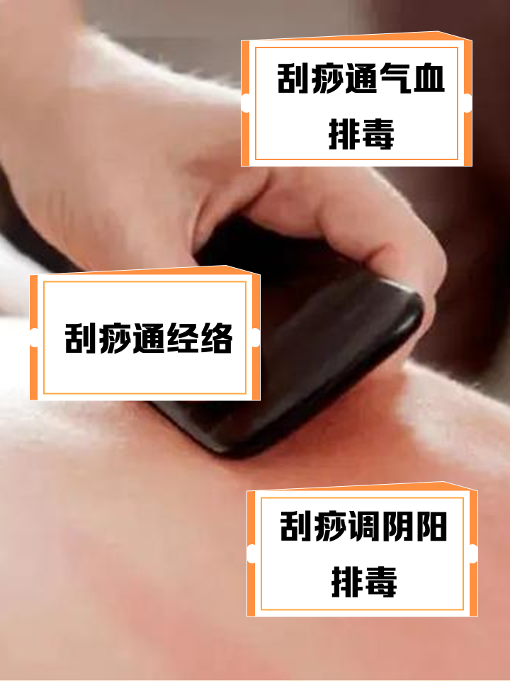 怎样刮痧