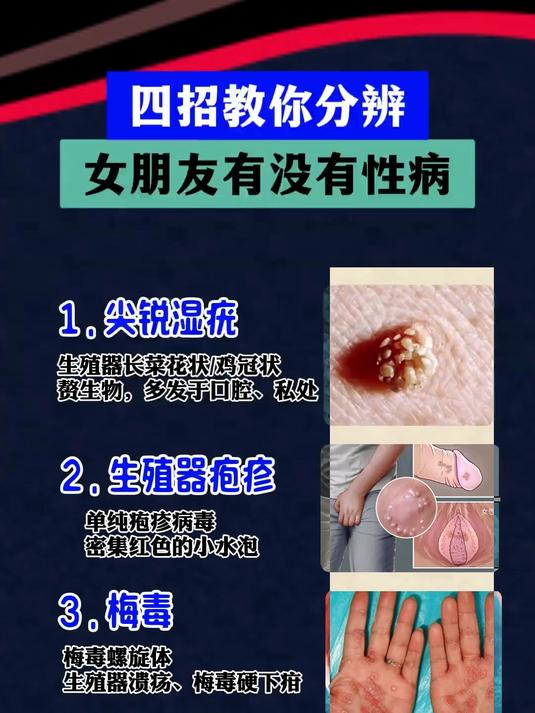 性病靠什么传染