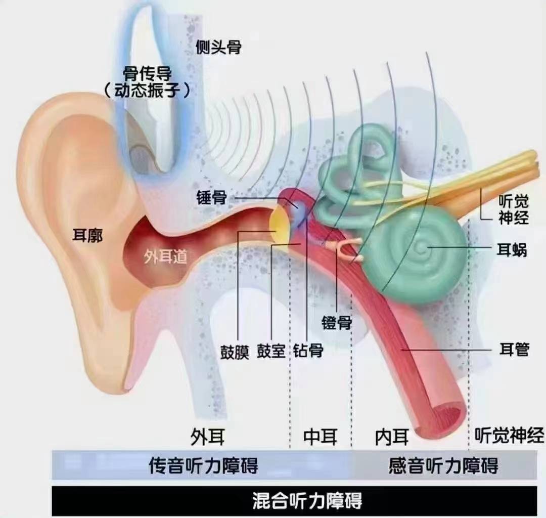 鼓膜内陷的原因
