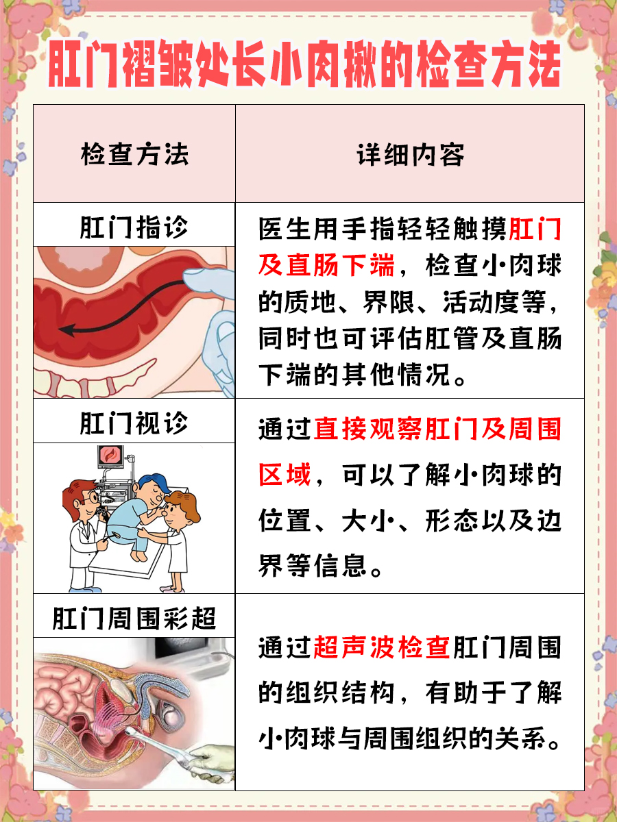 做肛门镜检查疼痛吗?