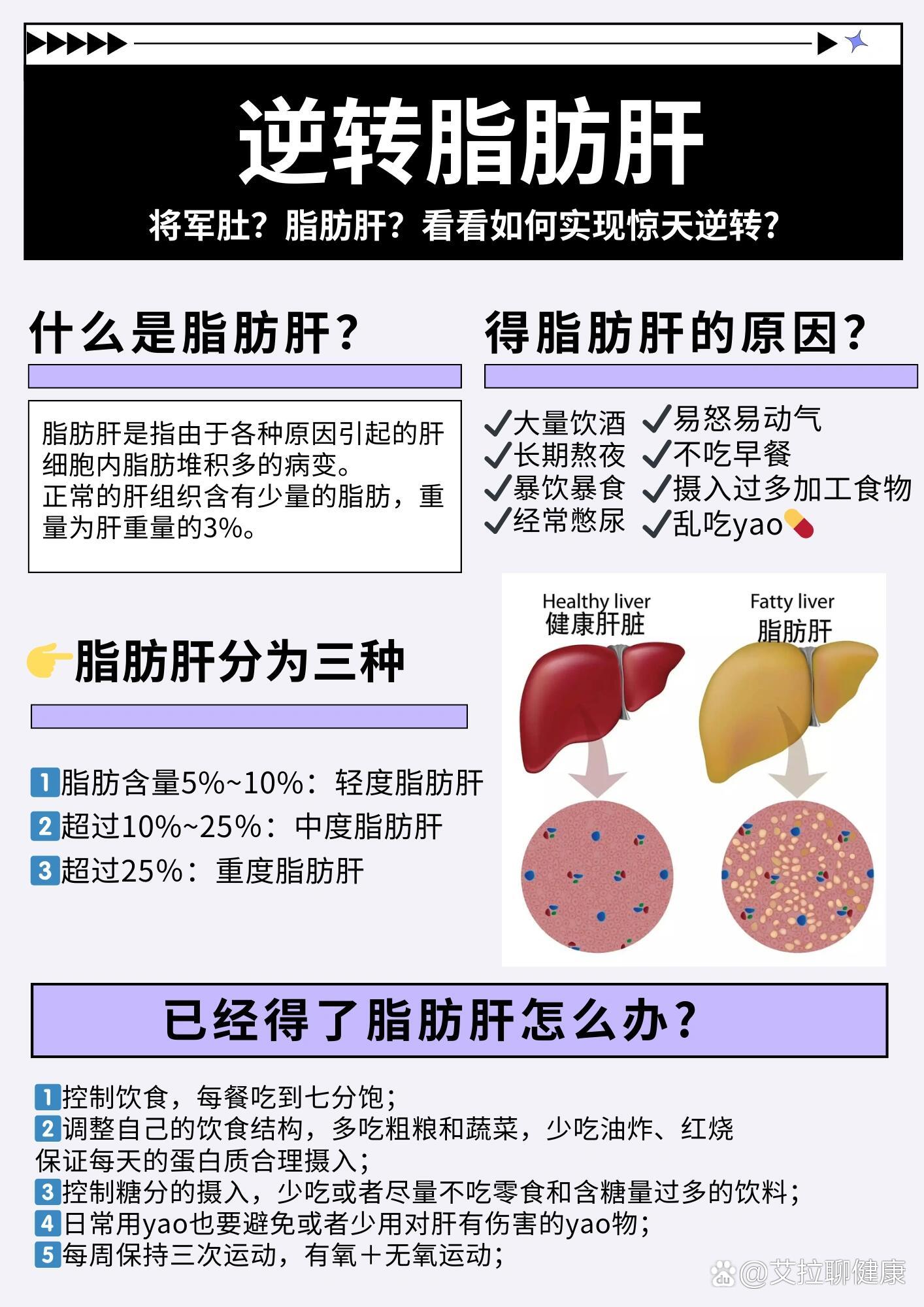 重度脂肪肝治疗方法有哪些