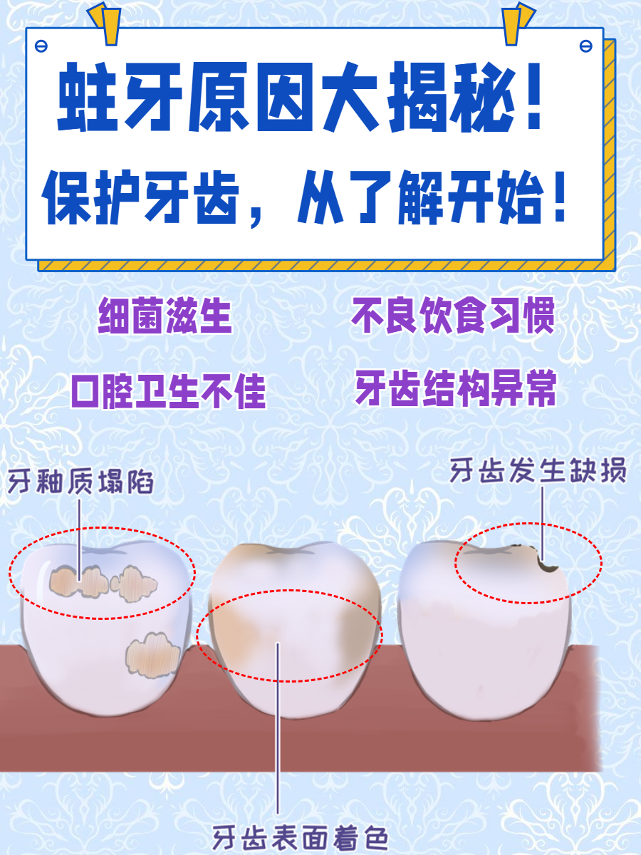 有蛀牙了怎么办