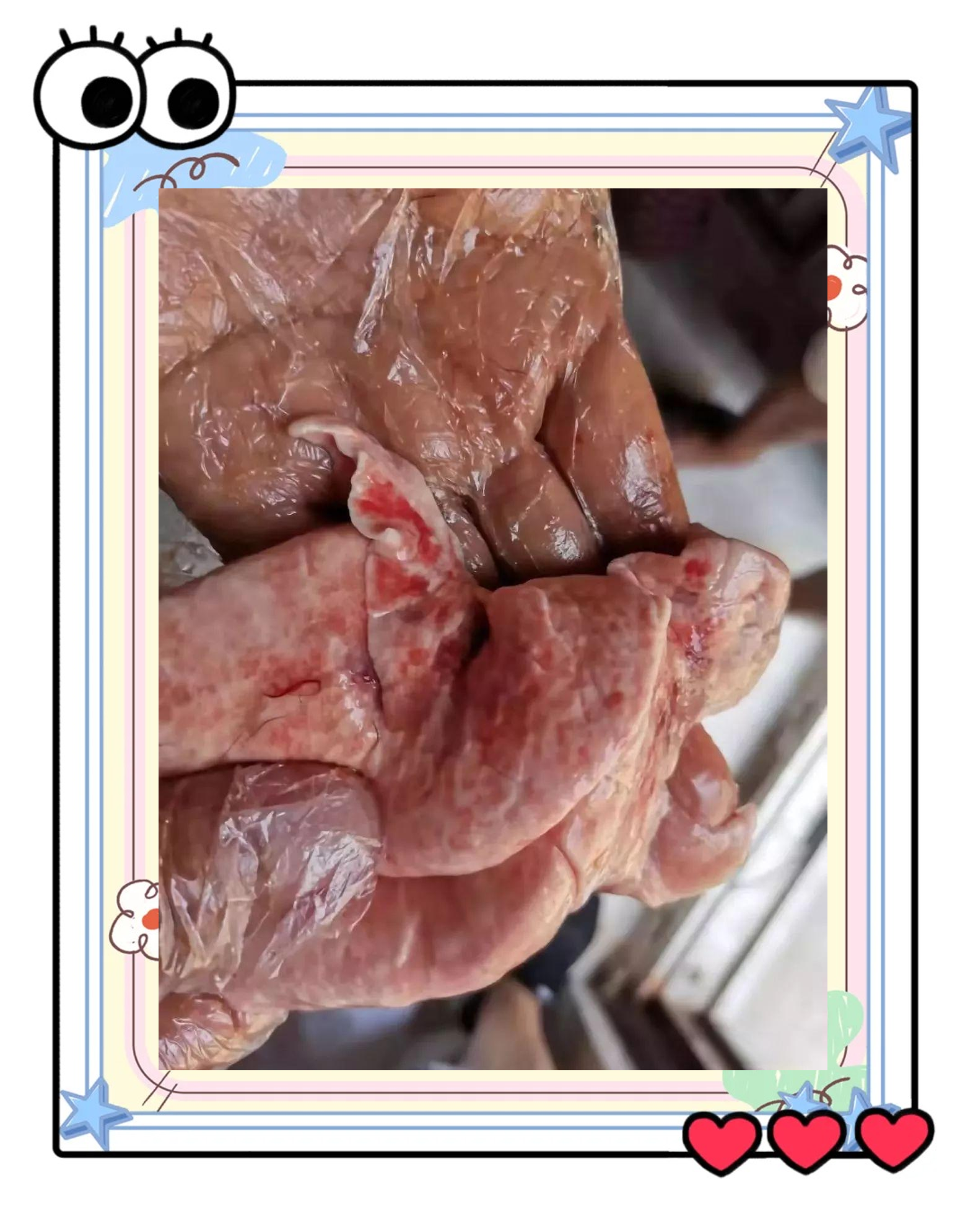 羊羔疯的常见症状有哪些