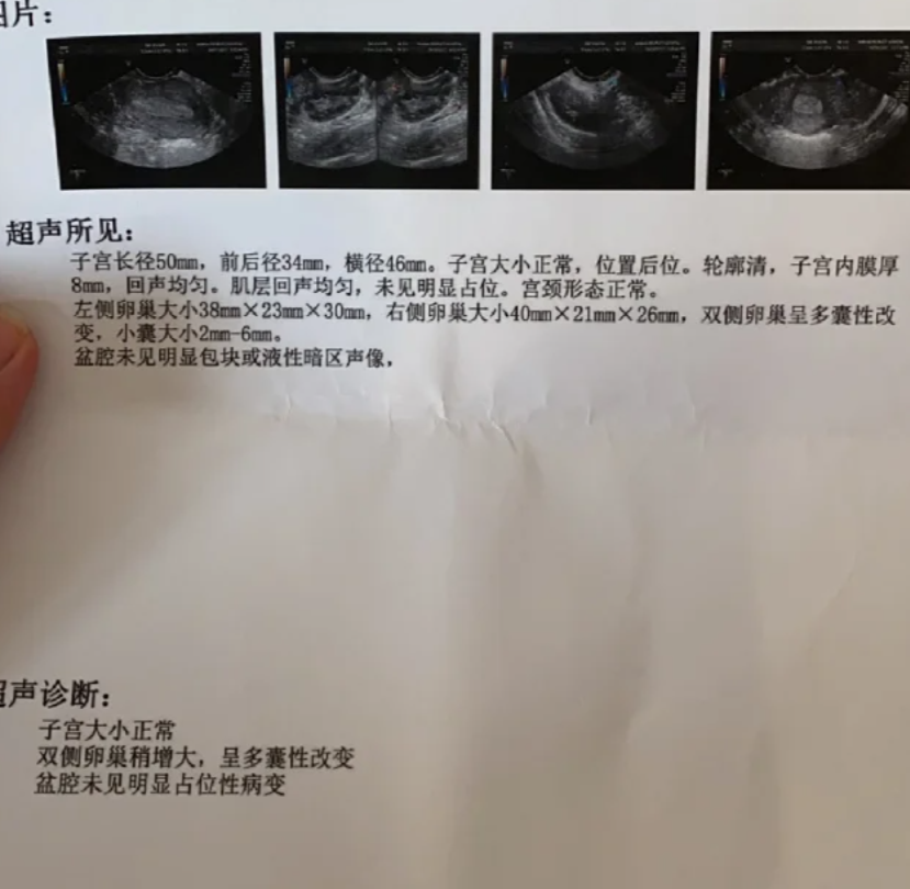 月经没来验孕棒一条杠怎么回事