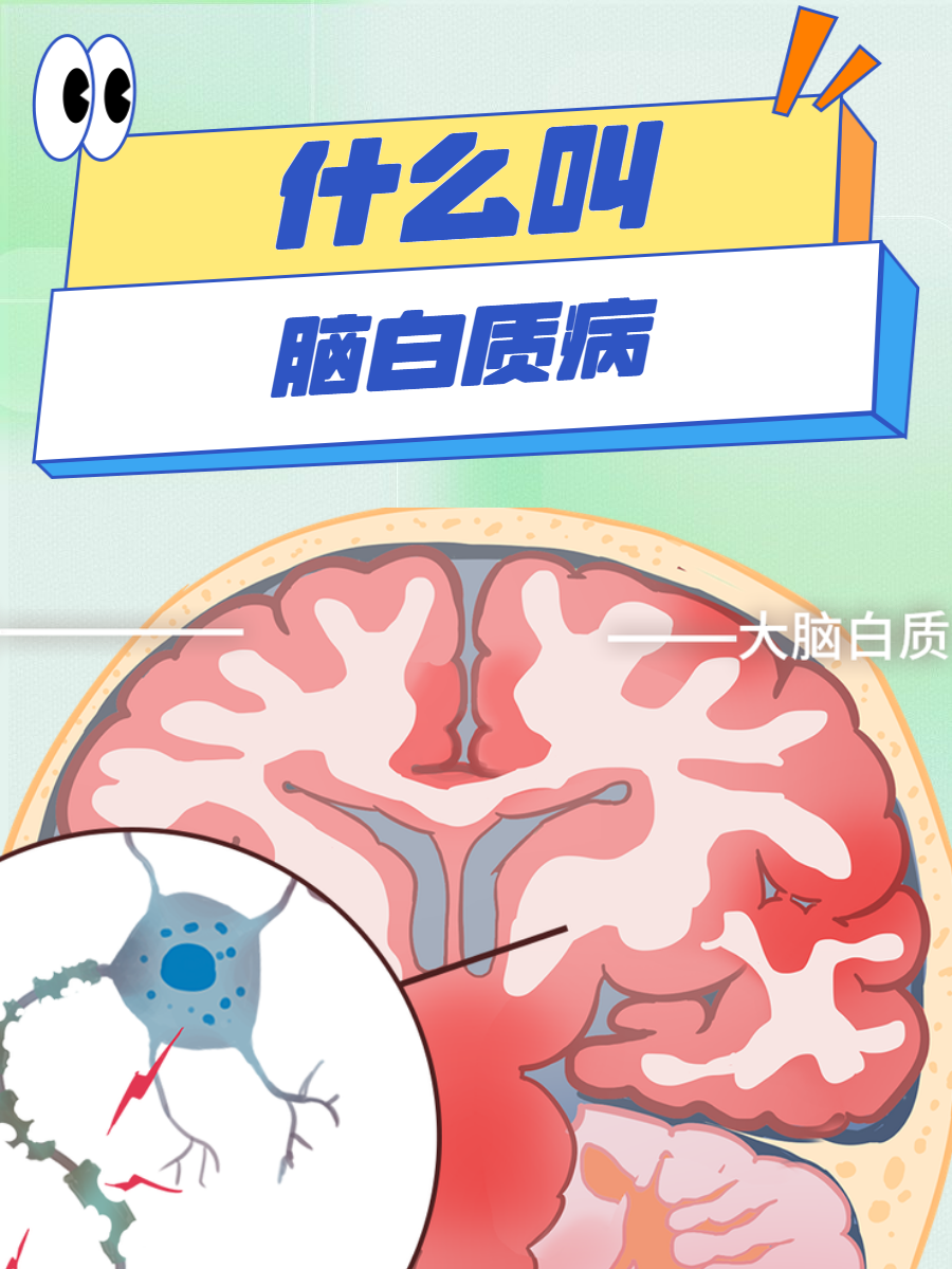 脑白质营养不良的症状
